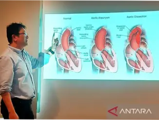 Dokter: Nyeri Dada Seperti Ditusuk Tanda Ada Robekan Dinding Aorta