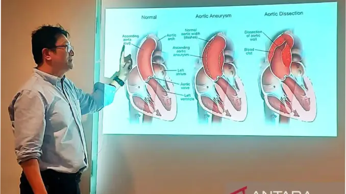 Dokter: Nyeri Dada Seperti Ditusuk Tanda Ada Robekan Dinding Aorta