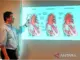 Dokter: Nyeri Dada Seperti Ditusuk Tanda Ada Robekan Dinding Aorta